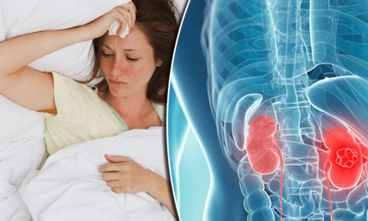 Managing nausea and vomiting in kidney patients