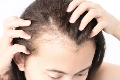 The link between low potassium and thinning hair